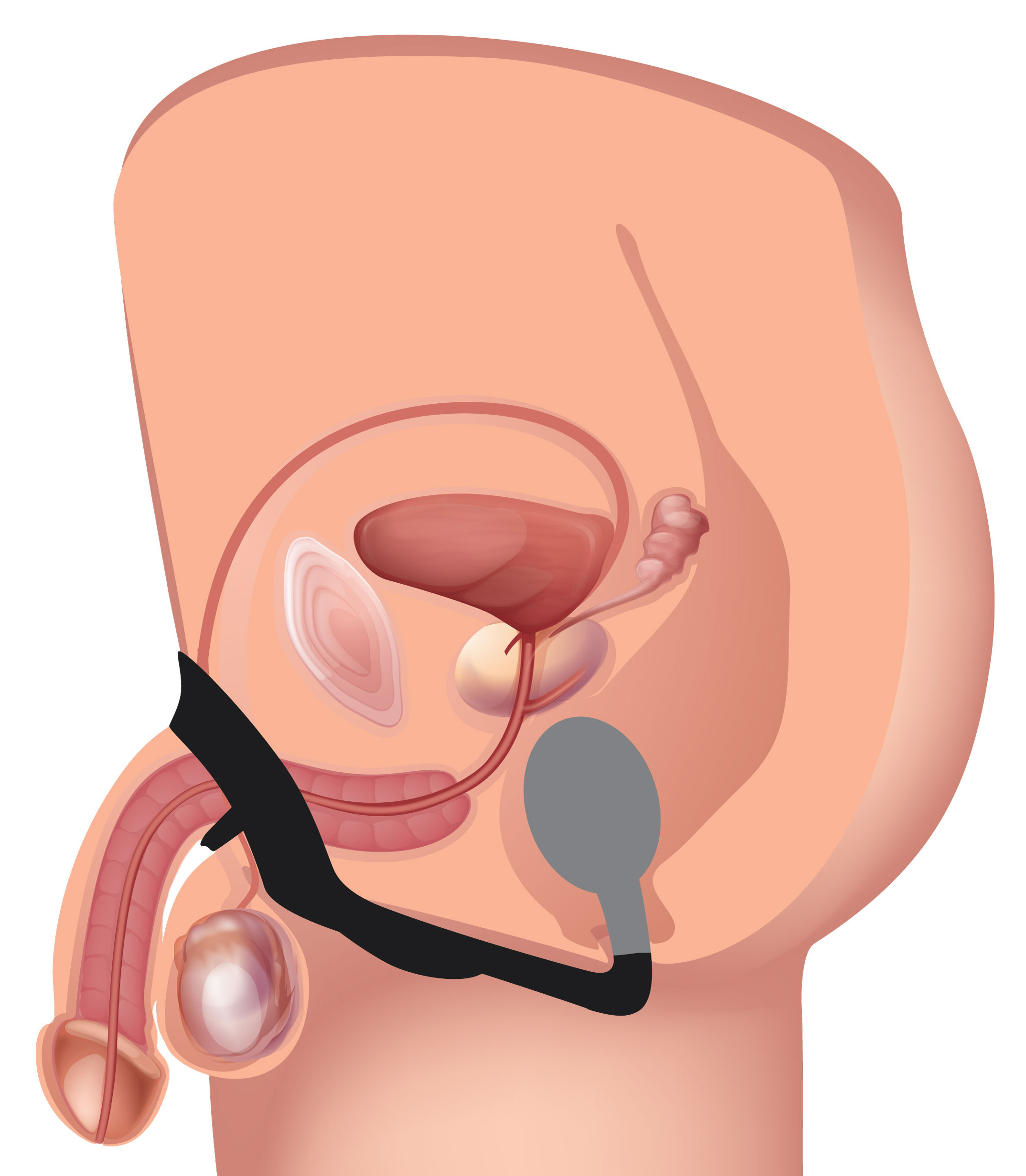 images/products/ag561-diagram-001